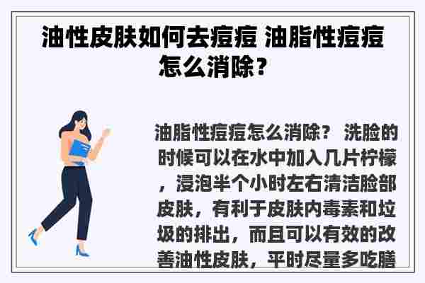 油性皮肤如何去痘痘 油脂性痘痘怎么消除？